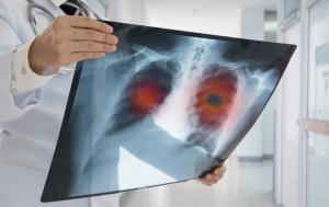 Røntgenbilleder: hvad dosis for mennesker er farligt?