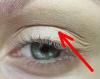 Hvordan at slippe af med hængende øjenlåg uden plast