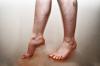 Overtrædelse af blodgennemstrømningen i benene: årsager, symptomer