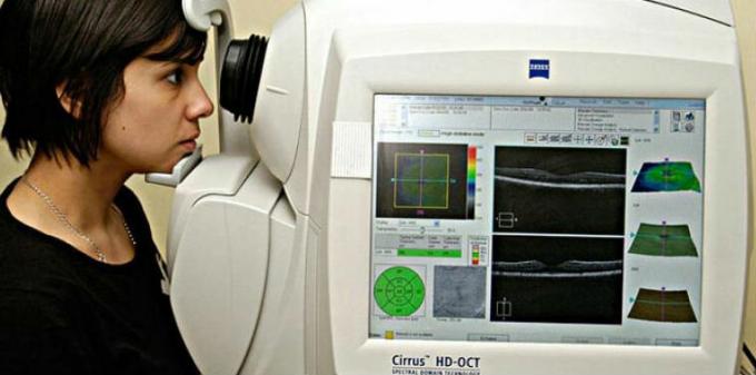 Optisk kohærens tomografi angiografi