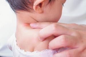 Ringorm er et barn: smittekilder, symptomer og behandling