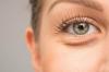 Poser under øjnene: kosmetologer rådgive om, hvordan man kan slippe