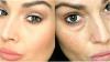 5 gamle opskrifter til at gøre udseendet frisk og elastisk hud omkring øjnene og unge