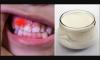 Hvordan undgår huller i tænderne og styrke immunsystemet
