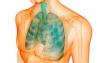 Lungesygdom, der kryber op ubemærket
