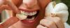 7 måder, hvordan at slippe af med lugten af ​​hvidløg mund
