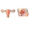 Hvad sker der med livmoderen før og efter fødslen: hvad der skal undersøgelsen