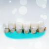 Populære ortoser tænder: hvor meget det effektivt?
