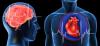 Hjerteanfald og slagtilfælde: 7 store fejl, at de provokerer