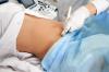 Hvor ofte skal du lave en ultralyd under graviditeten, siger lægen